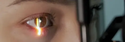 Comprehensive Diabetic Eye Exam in Cambridge, ON